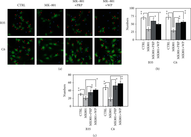 The Effects of Poria cocos on Rho Signaling-Induced Regulation of Mobility and F-Actin Aggregation in MK-801-Treated B35 and C6 Cells.