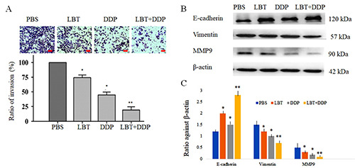 Lobetyolin suppressed lung cancer in a mouse model by inhibiting epithelial-mesenchymal transition.