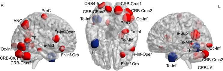 Brain Structural Correlates of Intelligence in Attention Deficit Hyperactivity Disorder (ADHD) Individuals.