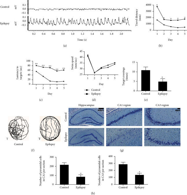 Proteomic Analysis Reveals the Vital Role of Synaptic Plasticity in the Pathogenesis of Temporal Lobe Epilepsy.