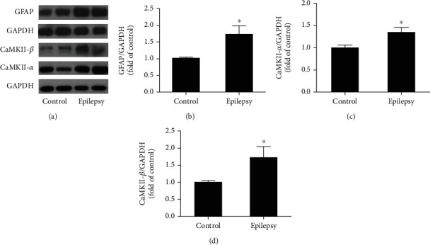 Proteomic Analysis Reveals the Vital Role of Synaptic Plasticity in the Pathogenesis of Temporal Lobe Epilepsy.