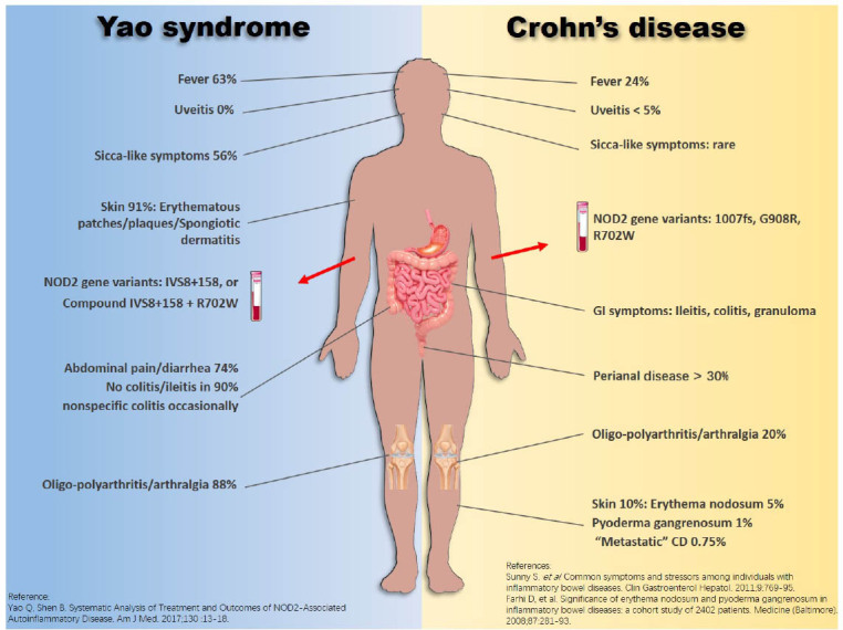 Inflammatory Bowel Disease: Focus on Enteropathic Arthritis and Therapy.