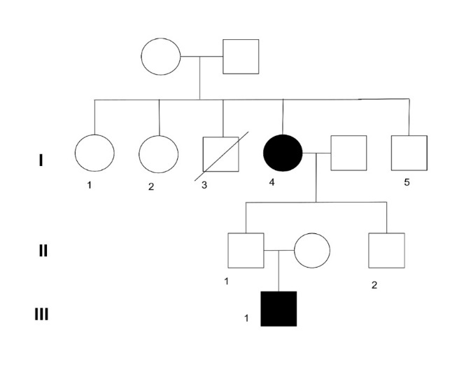 An Unusual Presentation of Bilateral Split Hand-Foot Malformation (SHFM) in Family: A Tale of Two Generations.