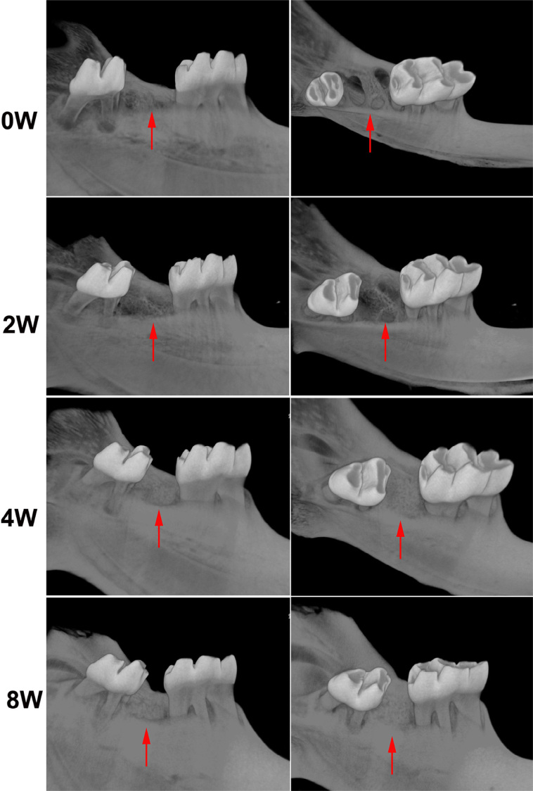 Characterizations of alveolar repair after mandibular second molar extraction: an experimental study in rats.