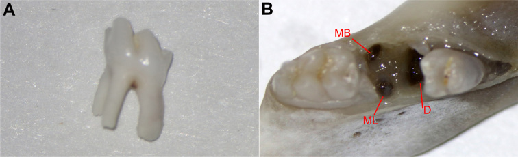 Characterizations of alveolar repair after mandibular second molar extraction: an experimental study in rats.