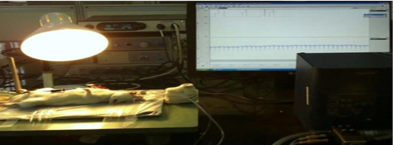 Investigation of the effect of 8 weeks of high-intensity interval training and berberine supplementation on some echocardiography and electrocardiogram indices following myocardial ischemia-reperfusion in rats.