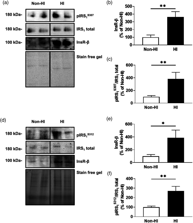 Hyperinsulinemia alters insulin receptor presentation and internalization in brain microvascular endothelial cells.