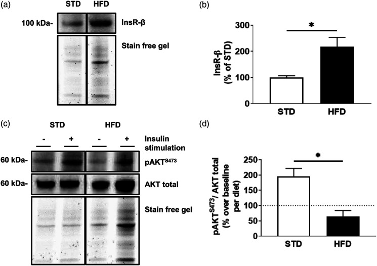 Hyperinsulinemia alters insulin receptor presentation and internalization in brain microvascular endothelial cells.
