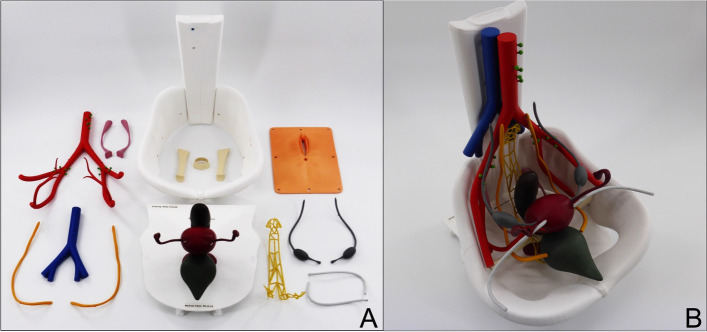 Evaluating the value of a 3D printed model for hands-on training of gynecological pelvic examination.