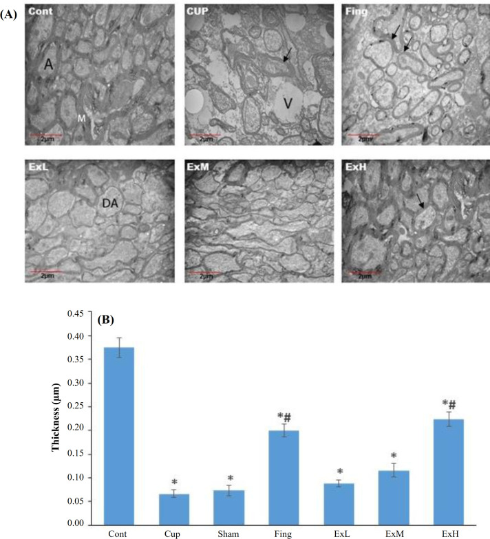 The effect of Zingiber Officinale Extract on Preventing Demyelination of Corpus Callosum in a Rat Model of Multiple Sclerosis