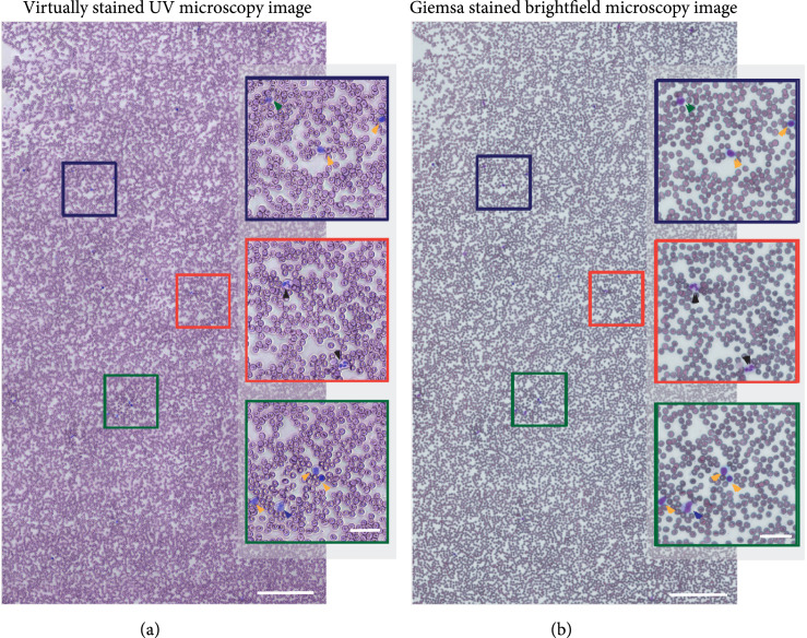 Virtual Staining, Segmentation, and Classification of Blood Smears for Label-Free Hematology Analysis.