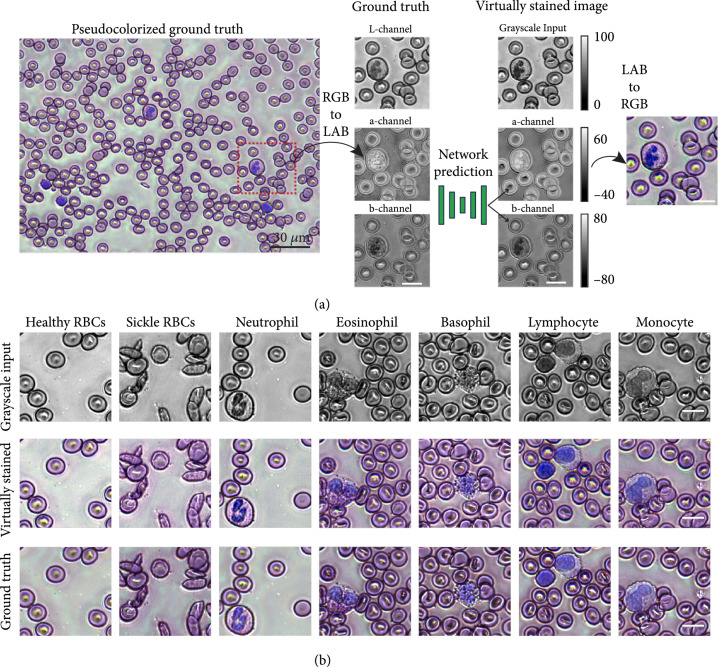 Virtual Staining, Segmentation, and Classification of Blood Smears for Label-Free Hematology Analysis.