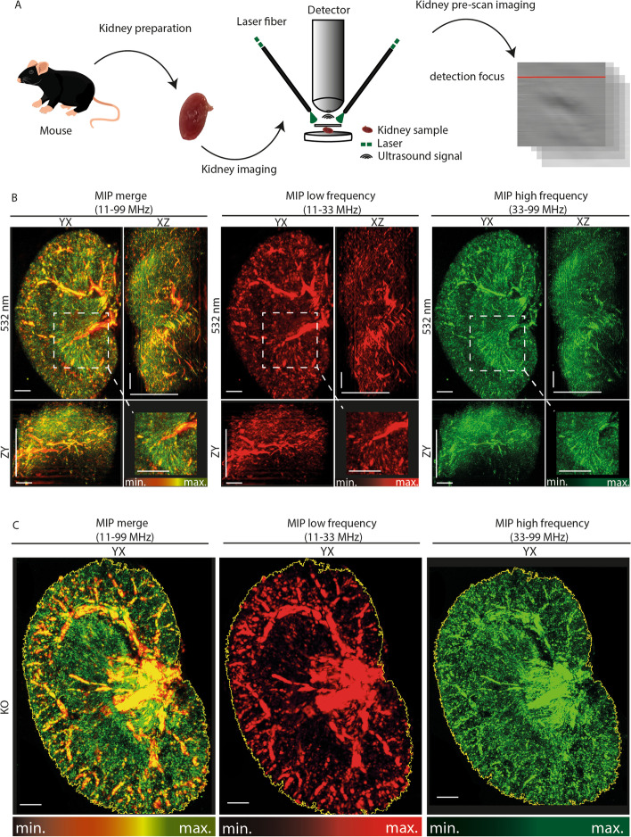 High-resolution label-free mapping of murine kidney vasculature by raster-scanning optoacoustic mesoscopy: an ex vivo study.