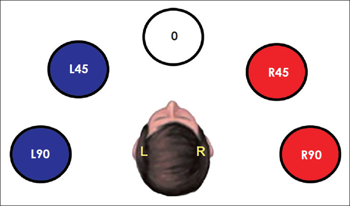 Effects of Spatial Training Paradigms on Auditory Spatial Refinement in Normal-Hearing Listeners: A Comparative Study.