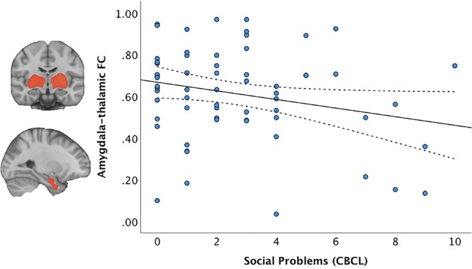 Amygdala subnuclei volumes, functional connectivity, and social-emotional outcomes in children born very preterm.