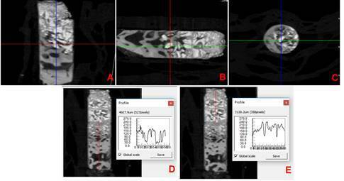 Effect of different thresholds on the accuracy of linear and volumetric analysis of native- and grafted-bone.