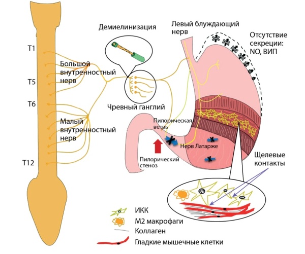 [Diabetic gastroenteropathy: modern methods of diagnosis and treatment].