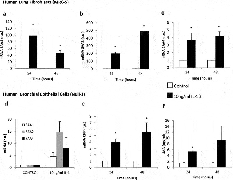 Cellular mechanisms involved in the pathogenesis of airway remodeling in chronic lung disease.