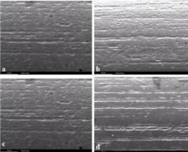 Effects of Two Fluoride Mouthwashes on Surface Topography and Frictional Resistance of Orthodontic Wires.