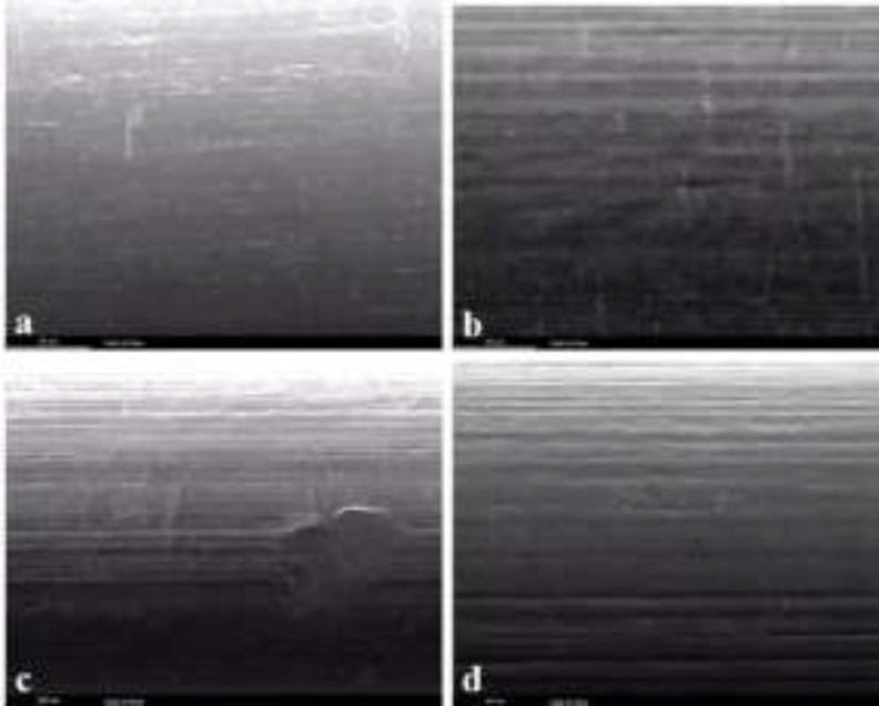 Effects of Two Fluoride Mouthwashes on Surface Topography and Frictional Resistance of Orthodontic Wires.