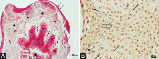 Global DNA methylation and chondrogenesis of rat limb buds in a three-dimensional organ culture system.