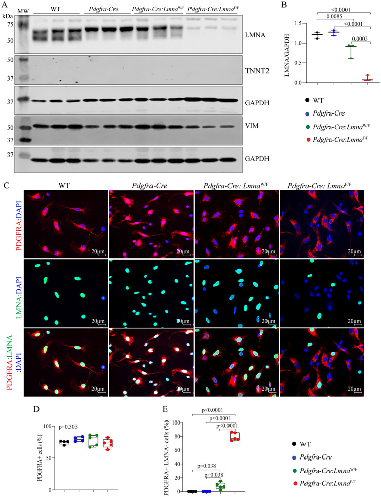 Deletion of the <i>Lmna</i> gene in fibroblasts causes senescence-associated dilated cardiomyopathy by activating the double-stranded DNA damage response and induction of senescence-associated secretory phenotype.