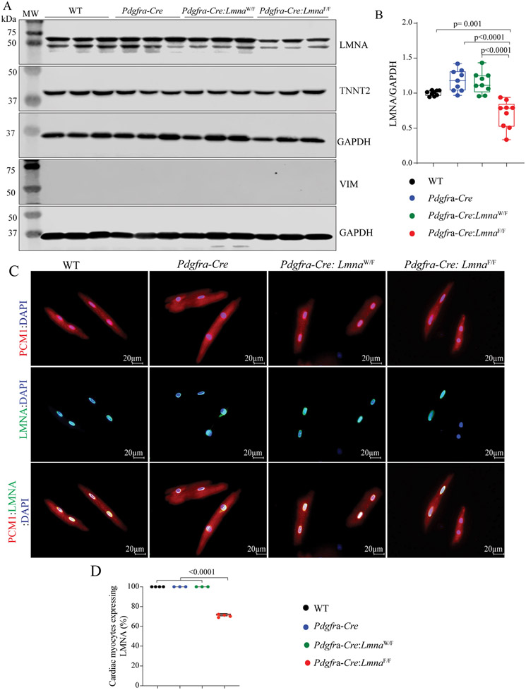 Deletion of the <i>Lmna</i> gene in fibroblasts causes senescence-associated dilated cardiomyopathy by activating the double-stranded DNA damage response and induction of senescence-associated secretory phenotype.