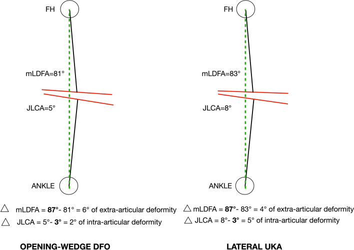 Distal femoral osteotomy versus lateral unicompartmental arthroplasty for isolated lateral tibiofemoral osteoarthritis with intra-articular and extra-articular deformity: a propensity score-matched analysis.