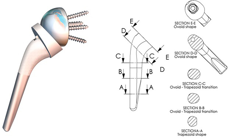 Specific Design of a Press Fit Humeral Stem Provides low Stress Shielding in Reverse Shoulder Arthroplasty at minimum 5 Years FU.