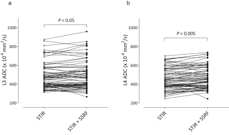 Assessing the ADC of Bone-marrow on Whole-body MR Images in Relation to the Fat-suppression Method and Fat Content.