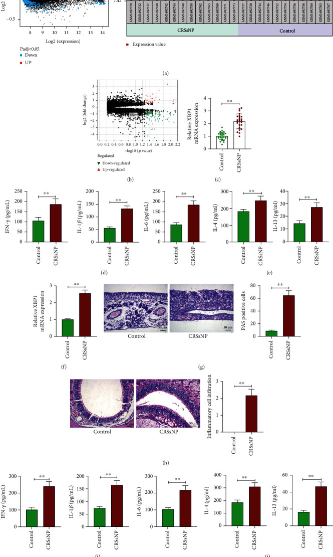 XBP1 Regulates the Transcription of HIF-1a in BALB/c Mice with Chronic Rhinosinusitis without Polyps.