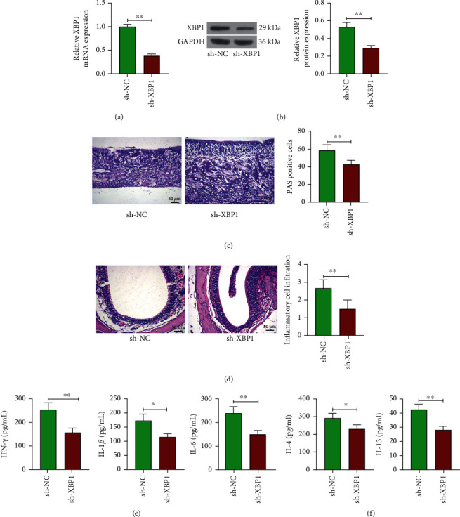 XBP1 Regulates the Transcription of HIF-1a in BALB/c Mice with Chronic Rhinosinusitis without Polyps.