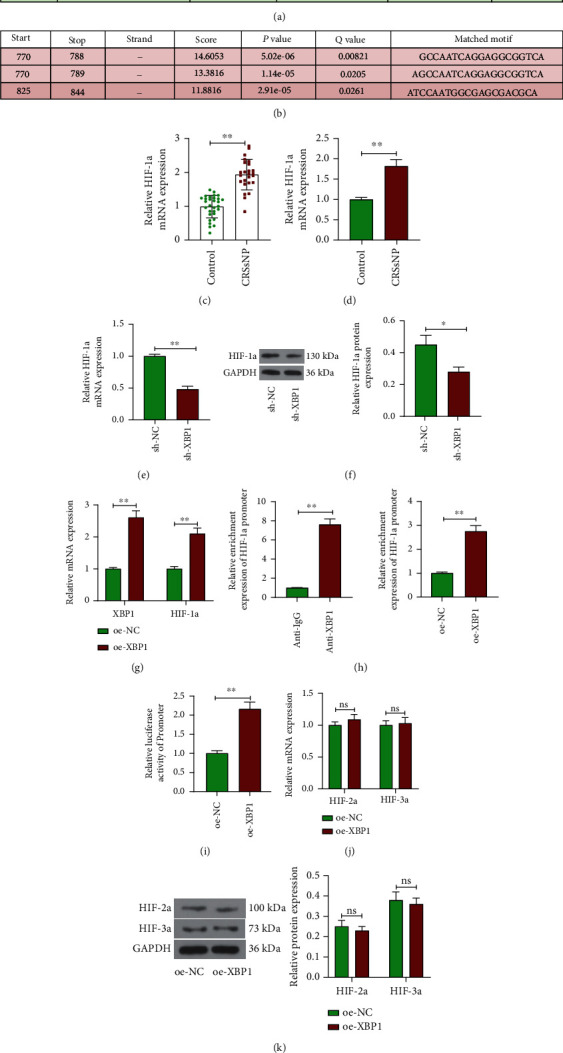 XBP1 Regulates the Transcription of HIF-1a in BALB/c Mice with Chronic Rhinosinusitis without Polyps.