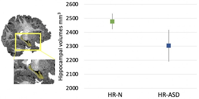 Joint attention in infants at high familial risk for autism spectrum disorder and the association with thalamic and hippocampal macrostructure.