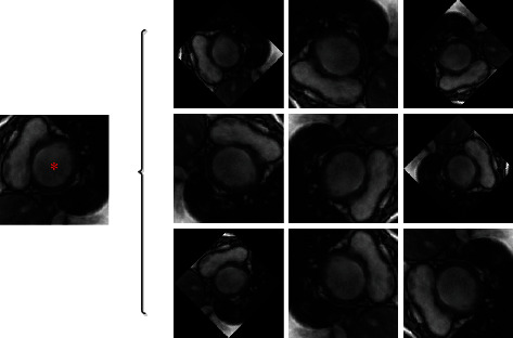 Left Ventricle Segmentation in Cardiac MR Images via an Improved ResUnet.