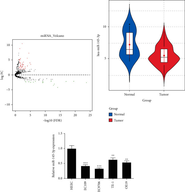 miR-145-3p Hampers the Malignant Progression of Esophageal Carcinoma via CXCL5 Downregulation.