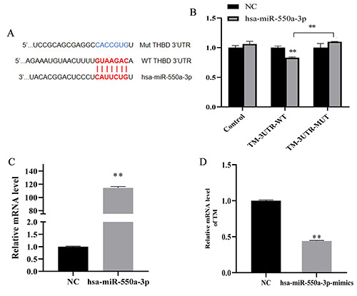 MiR-550a-3p restores damaged vascular smooth muscle cells by inhibiting thrombomodulin in an <em>in vitro</em> atherosclerosis model.