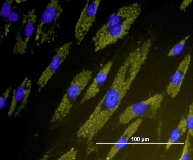 The combination of BMP12 and KY02111 enhances tendon differentiation in bone marrow-derived equine mesenchymal stromal cells (BM-eMSCs).