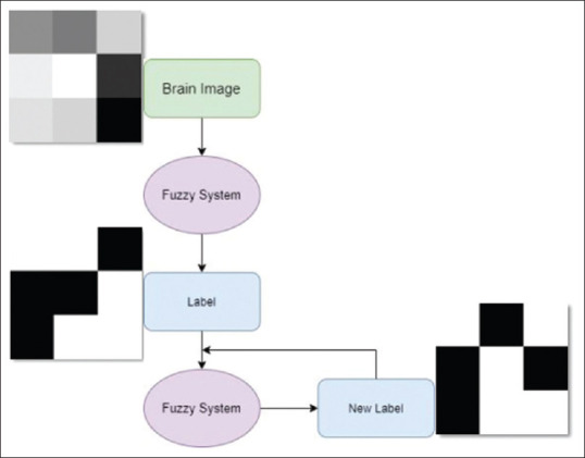Brain Tumor Segmentation using Hierarchical Combination of Fuzzy Logic and Cellular Automata.