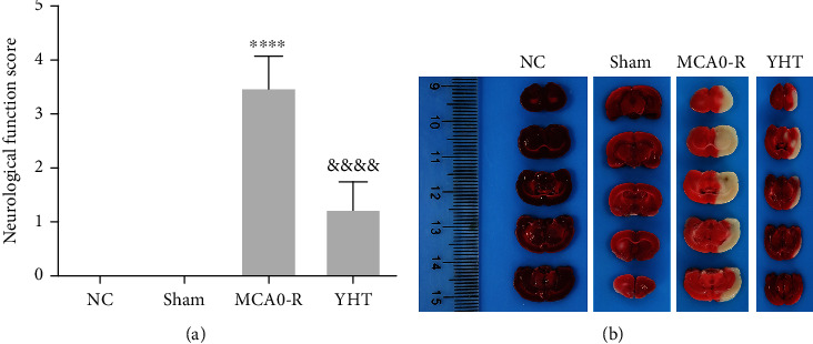 Metabolomics-Based Pharmacodynamic Analysis of Zhuang Yao Shuang Lu Tong Nao Granules in a Rat Model of Ischemic Cerebral Infarction.