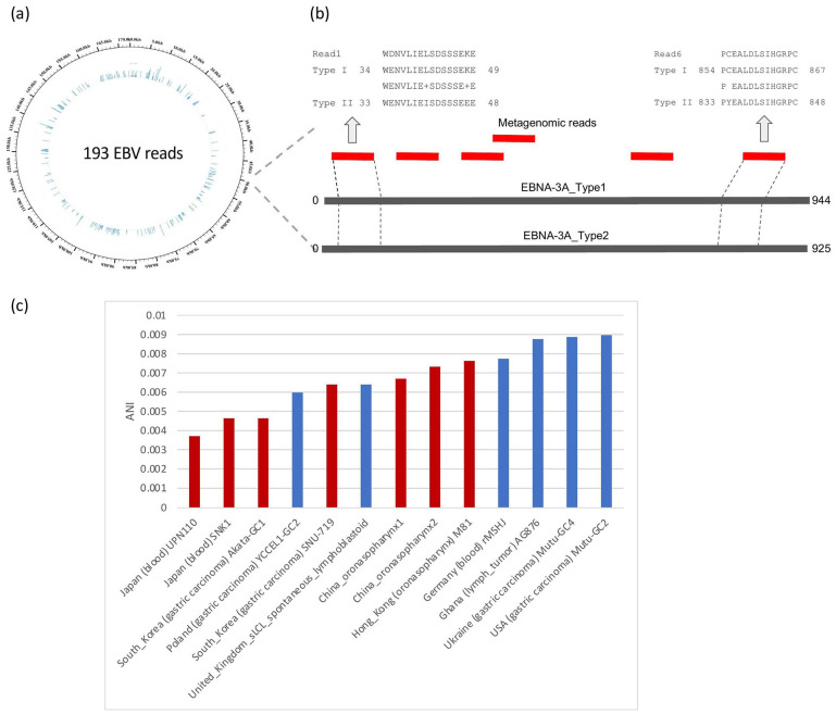 Metagenomic Sequencing and Histology on a Chronic Wound Identified Epstein-Barr Virus-Associated Lymphoma.