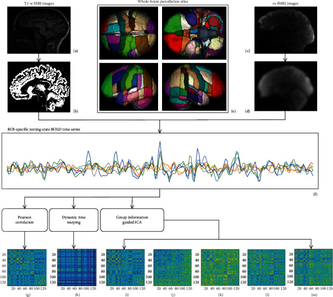 Identification of Alzheimer's Disease Progression Stages Using Topological Measures of Resting-State Functional Connectivity Networks: A Comparative Study.