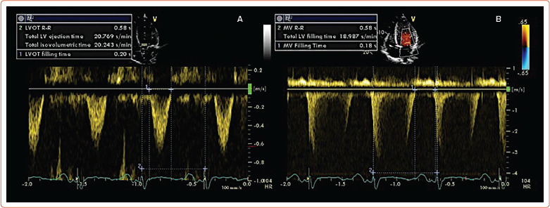 Intensive Care Management of the Cardiogenic Shock Patient.