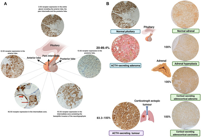 The dopaminergic control of Cushing's syndrome.