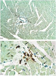 Morphological Signs of Neurogenic Inflammation in the Heart of Rats during Aging