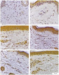 Changes in the Number of p23-Positive Fibroblasts in Human Dermis with Aging