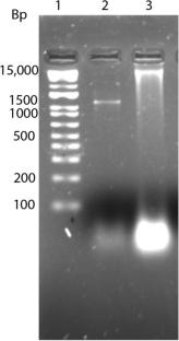 Ameliorative effects of Guilandina bonduc L. aqueous seed extract on letrozole induced polycystic ovary syndrome in female wistar albino rats