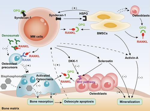 Pathophysiology and therapeutic advances in myeloma bone disease