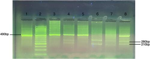 VDR gene polymorphisms are associated with the increased susceptibility to COVID-19 among iranian population: A case-control study