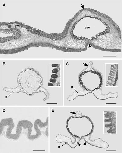 A new species of deep-sea torquaratorid enteropneust (Hemichordata): A sequential hermaphrodite with exceptionally wide lips